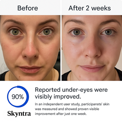 Skyntra MicroLift Patches